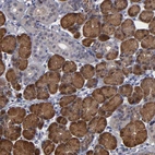 Immunohistochemical staining of human salivary gland shows strong cytoplasmic positivity in glandular cells.