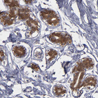 Anti-NDRG2 Antibody