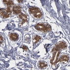 Immunohistochemical staining of human breast shows strong cytoplasmic positivity in glandular cells.