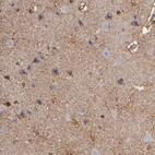 Immunohistochemical staining of human cerebral cortex shows strong cytoplasmic positivity in neuropil and glial cells.