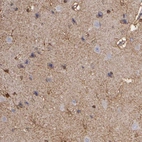 Immunohistochemical staining of human cerebral cortex shows strong cytoplasmic positivity in neuropil and glial cells.