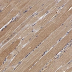 Immunohistochemical staining of human skeletal muscle shows moderate cytoplasmic positivity in myocytes.
