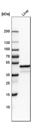 Western blot analysis in human liver tissue.