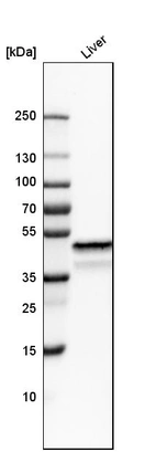 Western blot analysis in human liver tissue.