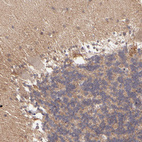 Anti-ZFYVE1 Antibody