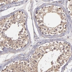 Immunohistochemical staining of human testis shows moderate positivity in cytoplasm granular in cells in seminiferous ducts.