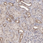 Immunohistochemical staining of human kidney shows strong positivity in cytoplasm granular in cells in tubules.