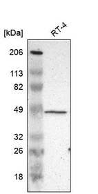 Western blot analysis in human cell line RT-4.