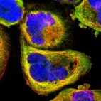 Immunofluorescent staining of human cell line A-431 shows localization to endoplasmic reticulum.