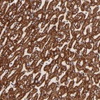 Anti-ECH1 Antibody