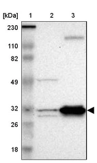 Lane 1: Marker [kDa] 230, 110, 82, 49, 32, 26, 18_br/_Lane 2: Human cell line RT-4_br/_Lane 3: Human cell line U-251MG sp