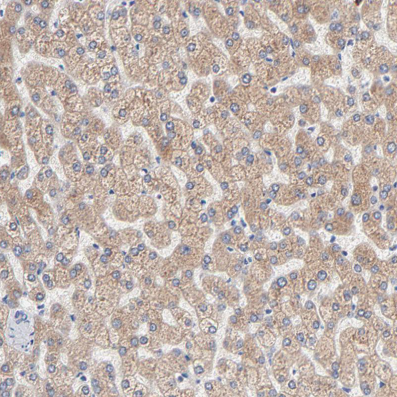 Anti-AADAC Antibody