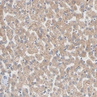 Anti-AADAC Antibody