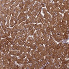 Anti-PHKA2 Antibody