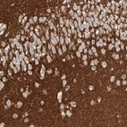 Anti-GPM6B Antibody