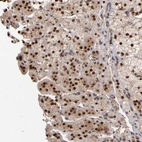 Anti-EAPP Antibody