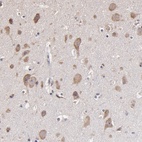 Anti-OPHN1 Antibody