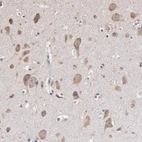 Anti-OPHN1 Antibody