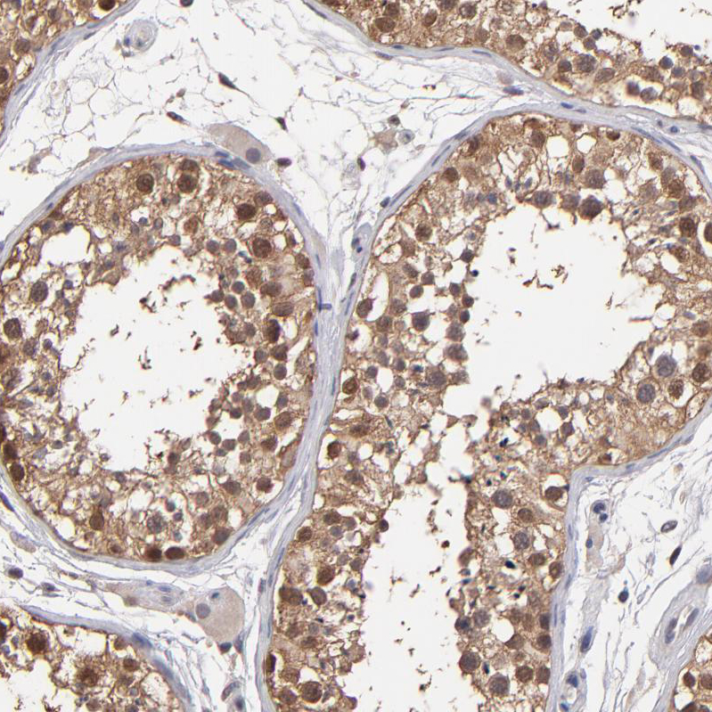Anti-PSMD10 Antibody