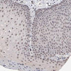 Immunohistochemical staining of human skin shows weak nuclear positivity in squamous epithelial cells.