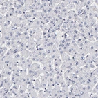 Immunohistochemical staining of human liver shows no cytoplasmic positivity in hepatocytes as expected.