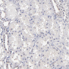 Anti-PSMD10 Antibody