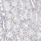 Immunohistochemical staining of human kidney shows no cytoplasmic positivity in cells in tubules as expected.