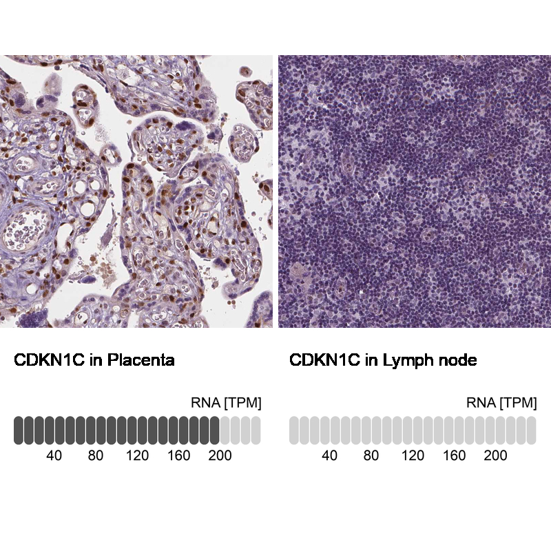 Anti-CDKN1C Antibody