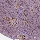 Immunohistochemical staining of human pancreas shows strong nuclear positivity in islets of Langerhans.
