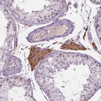 Immunohistochemical staining of human testis shows strong nuclear and cytoplasmic positivity in Leydig cells.