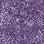 Immunohistochemical staining of human lymph node shows no nuclear positivity in germinal center cells as expected.