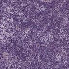 Immunohistochemical staining of human lymph node shows no nuclear positivity in germinal center cells as expected.