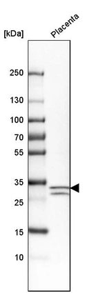 Western blot analysis in human placenta tissue.