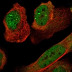 Immunofluorescent staining of human cell line U-2 OS shows localization to nucleoplasm, nuclear bodies & cytosol.