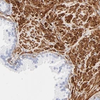 Immunohistochemical staining of human prostate shows strong cytoplasmic positivity in smooth muscle cells.
