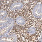 Immunohistochemical staining of human endometrium shows strong cytoplasmic positivity in stromal cells.