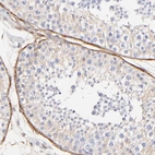 Immunohistochemical staining of human testis shows moderate cytoplasmic positivity in peritubular myoid cells.