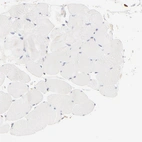 Immunohistochemical staining of human skeletal muscle shows no cytoplasmic positivity in myocytes as expected.