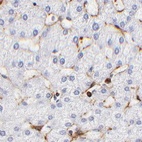 Anti-FLNA Antibody