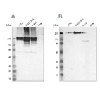 Western blot analysis using Anti-FLNA antibody HPA002925 (A) shows similar pattern to independent antibody HPA001115 (B).