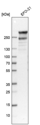 Western blot analysis in human cell line EFO-21.