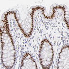 Immunohistochemical staining of human colon shows moderate to strong nuclear positivity in glandular cells.