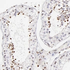 Immunohistochemical staining of human testis shows moderate to strong nuclear positivity in a subset of cells in seminiferous ducts.