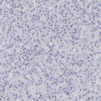 Anti-KLF4 Antibody