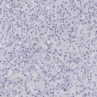 Immunohistochemical staining of human pancreas shows no positivity in exocrine glandular cells as expected.