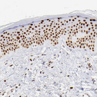 Immunohistochemical staining of human skin shows moderate to strong nuclear positivity in keratinocytes.