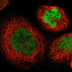 Immunofluorescent staining of human cell line A-431 shows localization to nucleoplasm.