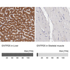 Anti-ENTPD5 Antibody