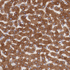 Anti-ENTPD5 Antibody