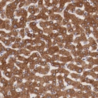 Immunohistochemical staining of human liver shows strong cytoplasmic positivity in hepatocytes.